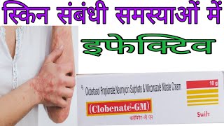 Clobenate  GM cream Uses and side effects in Hindi  क्लोबिनेट जी एम क्रीम की जानकारी [upl. by Ahsonek972]