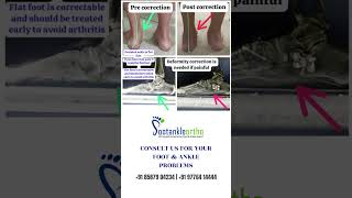 FOOT DEFORMATION CORRECTION footproblem deformationoffoot footandanklesurgeon footcondition [upl. by Aleicarg]