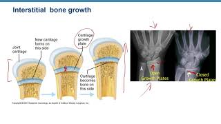 Video Lecture Ex 8 Regions of the Epiphyseal Plate [upl. by Tiat]