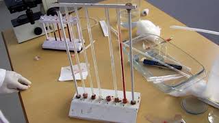 Erythrocyte sedimentation rate [upl. by Aronoel]