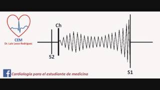 Soplo de la estenosis mitral [upl. by Windham]