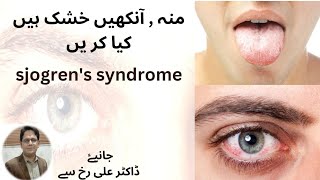 Sjogrens Syndrome symptoms and treatment by Dr Alirukhمنہ ، آنکھیں خشک ہیں کیا کریں ۔ sjogrens [upl. by Fisoi]