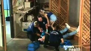 Rescue 911 Mans Wrist vs Circular Saw [upl. by Erny]