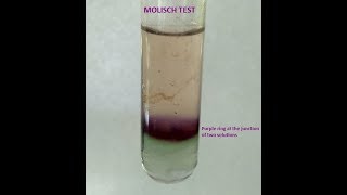 Molisch Testa group test for Carbohydrates [upl. by Elgna574]