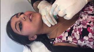 Neck Microdermal Procedure  Microdermal Implant Procedure  Madison Microdermal Piercings [upl. by Atsyrt]