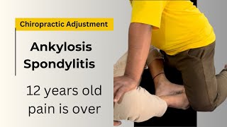 Ankylosing Spondylitis  Symptoms and Treatment Rheumatologist [upl. by Ober]