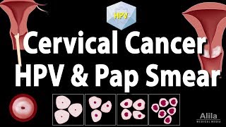 Cervical Cancer HPV and Pap Test Animation [upl. by Yznil]