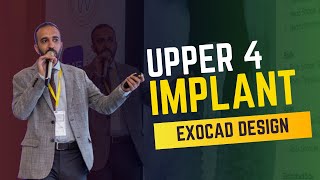 Exocadupper premolar 4 implant اكسوكاد تصميم زرعة للضاحك العلوى [upl. by Repip]