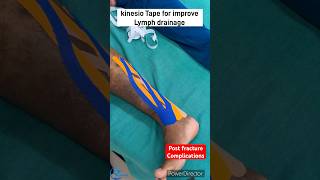 Kinesio taping for improve lymphatic drainage How to reduce edema kinesiotape kinesiotherapy [upl. by Eniamaj]