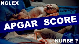 APGAR SCORE  How to check APGAR score  Apgar score assessment  Apgar score newborn [upl. by Akenit615]