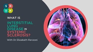 What is Interstitial Lung Disease in Systemic Sclerosis [upl. by Sapphera]