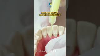 Periocline Periodontal Ointment Sunstar [upl. by Anod]