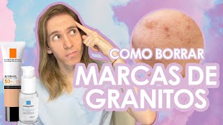 😨Cómo ELIMINAR un GRANO de la CARA correctamente👍🏻 [upl. by Naed]