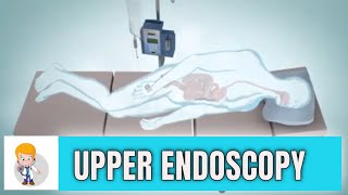 Upper GI endoscopy Esophagogastroduodenoscopy Animation 3D [upl. by Titus137]