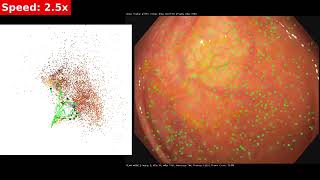 CudaSIFT SLAM Cecum exploration non real time Elvira et al [upl. by Dnalwor]