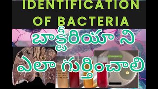 identification of bacteria in telugubacteria identificationbacteriology classmedtelugu3599 [upl. by Tychon]