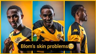 Kaizer Chiefs🟡⚫️fans make fun of Njabulo Bloms skin problems and Oswin Apolis 🤝to Kaizer Chiefs🔥✌️ [upl. by Roderica438]