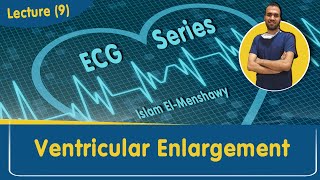 Ventricular Enlargement  Lecture 9 [upl. by Bradley]