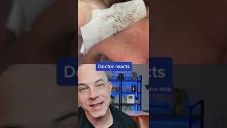 Derm reacts to incredibly satisfying pore strip removal dermreacts porestrip blackheads [upl. by Nemaj]