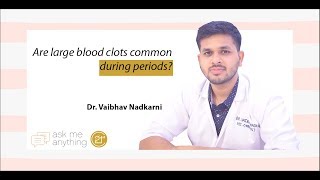 Are large blood clots common during periods By Dr Vaibhav Nadkarni [upl. by Crofton649]