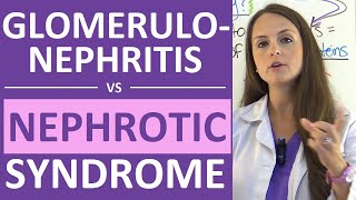 Nephrotic Syndrome vs Glomerulonephritis  Nephritic vs Nephrotic Syndrome Nursing NCLEX [upl. by Atinuaj]