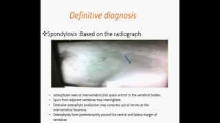 Spondylosis deformans [upl. by Kazue]