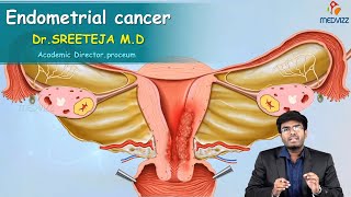 Endometrial Cancer  Obstetrics and gynaecology Video lectures Version 20  Medvizz app [upl. by Smallman]