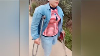 The beautiful woman is an amputee and lives with one leg walking with crutches amplife [upl. by Olenka997]