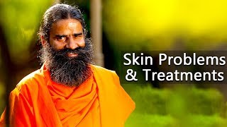 Skin Problems amp Treatments  Swami Ramdev [upl. by Parks]