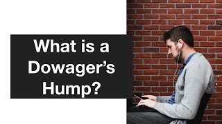 What is a Dowagers Hump [upl. by Nrol]