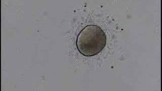 fertilization of sanddollar eggs [upl. by Naarah]