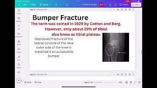 Fracture   part  2 l physiotherapist l AIIMS l jipmeri I pigmer l ESI I RRB l orthopaedicslDSSBl [upl. by Annibo]