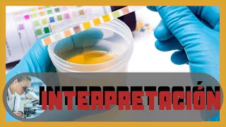 🅴🆇🅰🅼🅴🅽 general de ORINA 🔬 Interpretación CLINICA 🩺 EGO  analisis de orina [upl. by Ardnassak]