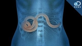 Why Parasites May Not Be All That Bad [upl. by Hubsher]