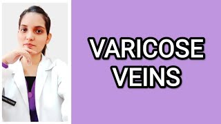 VARICOSE VEINSSURGERYEXPLAINED WITH MANIPAL MANUAL OF SURGERY Dr Deeksha [upl. by Aniz614]