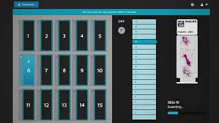 Digital pathology PIPS 5 solution video [upl. by Ardnovahs]