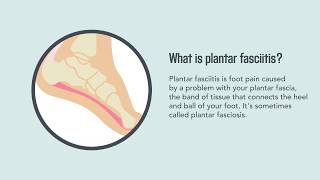 Plantar Fasciitis Causes Symptoms and Treatment  Merck Manual Consumer Version [upl. by Salvucci258]