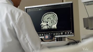 New Portable MRI Might Help Save Your Life After a Stroke [upl. by Anirtal893]