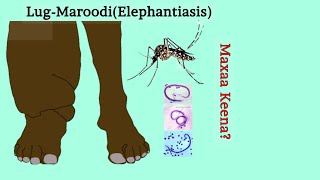 Maxaa keena xanuunka LugMaroodiga Elephantiasis [upl. by Bergren680]