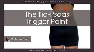 The Psoas Trigger Point [upl. by Baptist]