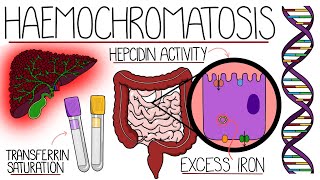 Understanding Haemochromatosis Hereditary amp Secondary [upl. by Niac]