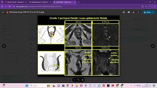 RADIOLOGY EXAM CASES [upl. by Lane406]