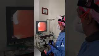 Endoscopia Digestiva alta bajo sedación [upl. by Remark152]