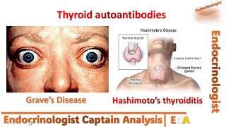 Understanding Autoimmune Thyroid Disease [upl. by Mylor]