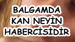 BALGAMDA KAN NEYİN HABERCİSİDİR [upl. by Llarret]