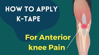 How to apply Kinesiology tape for knee pain  Patella Femoral Syndrome  Osgood Schlatters Syndrome [upl. by Nyltak]