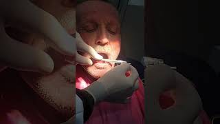 dental implants dentalclinic viralshorts video [upl. by Oos]