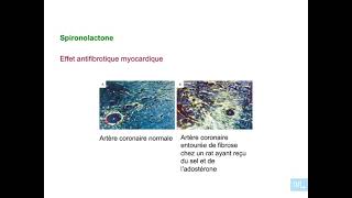 15  Pharmacologie du systeme renine angiotensine aldosterone partie 6 [upl. by Gough968]