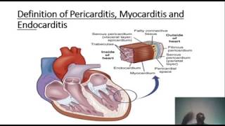 LEARN ABOUT PERICARDITIS MYOCARDITIS AND ENDOCARDITIS [upl. by Morganica]