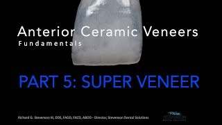 Anterior Ceramic Veneers Part 5 Super Veneer [upl. by Ytnom804]